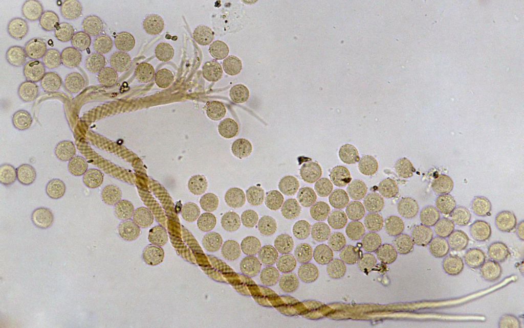 Prototrichia cf metallica